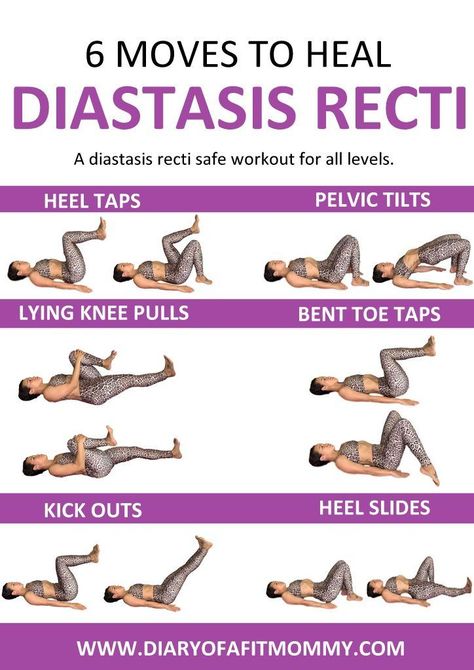 Heal and repair your Diastasis Gap at home with this workout. These exercises are gentle for the postpartum core. Recti Diastasis, Heal Diastasis Recti, Diástase Abdominal, Healing Diastasis Recti, Post Baby Workout, Fitness Diary, Diastasis Recti Exercises, Post Pregnancy Workout, Latihan Yoga