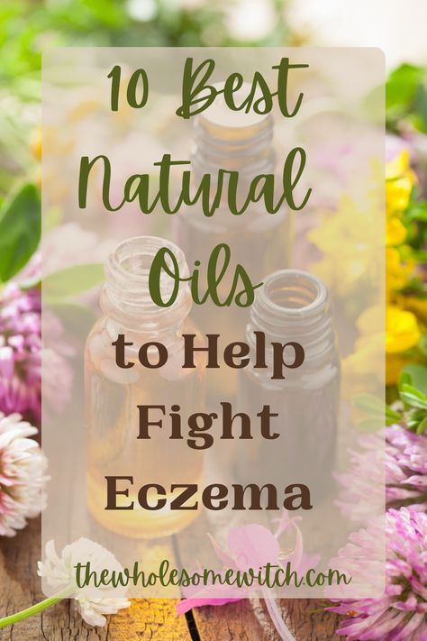 Eczema can be a constant battle. It's always nice to have some go to natural remedies at your disposal! Click through for 10 of the best carrier and essential oils to help treat eczema and dry skin naturally. #naturalliving #essentialoils #holisticliving #naturalremedies #eczemaremedies Oils For Sinus, Dry Skin Remedies, Skin Natural Remedies, Essential Oils For Skin, Skin Remedies, Best Essential Oils, Best Oils, Essential Oil Recipes, Life Tips