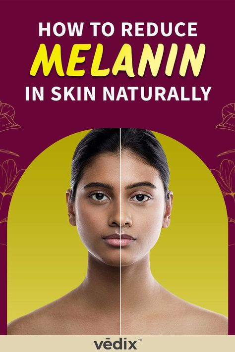 How To Reduce Melanin In Skin Naturally Melanin Reducing Tips, How To Decrease Melanin In Skin, How To Reduce Melanin In Skin Naturally, How To Brighten Skin Naturally, How To Reduce Melanin In Skin, Sun Damaged Skin Remedies, Dull Skin Remedies, Remedies For Hyperpigmentation, Imbalanced Hormones