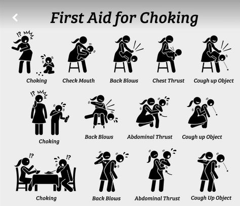 First Aid Poster, Heimlich Maneuver, Safety Poster, First Aid Tips, Miniature People, Trening Sztuk Walki, Social Life Hacks, Survival Skills Life Hacks, Body Map