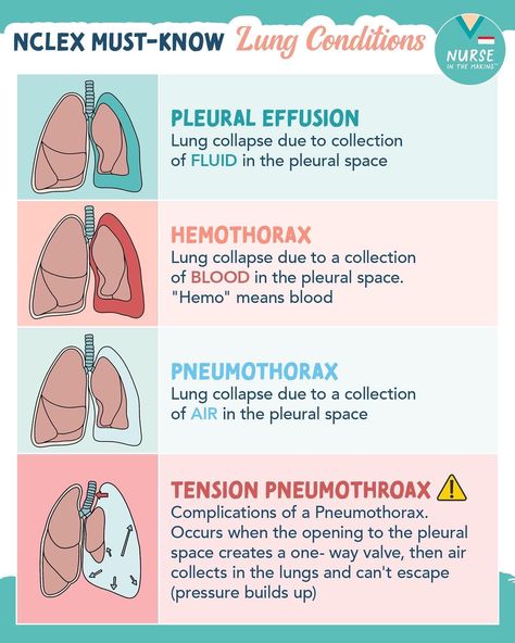 Nclex Must Know, Nclex Hacks, Sports Chiropractic, Nursing Clinicals, Er Nursing, Nursing Hacks, Nursing School Studying Cheat Sheets, Med Notes, Student Essentials