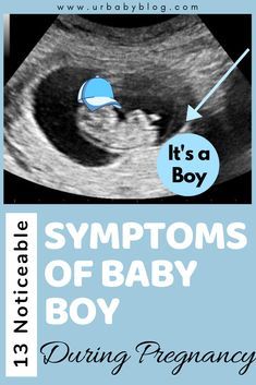 Gender Reveal Boy Announcement, Baby Boy Ultrasound Pictures, It’s A Boy Pregnancy Announcement, Boy Or Girl Prediction Signs, We Are Pregnant Announcement, Gender Announcement Pictures, Baby Boy Gender Announcement, Monthly Pregnancy Pictures, Boy Vs Girl Pregnancy