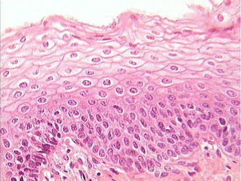 stratified squamous epithelium Simple Squamous Epithelium, Squamous Epithelium, Epithelial Tissue, Stratified Squamous Epithelium, Squamous Cell, Biology Facts, Art Major, Connective Tissue, Anatomy And Physiology