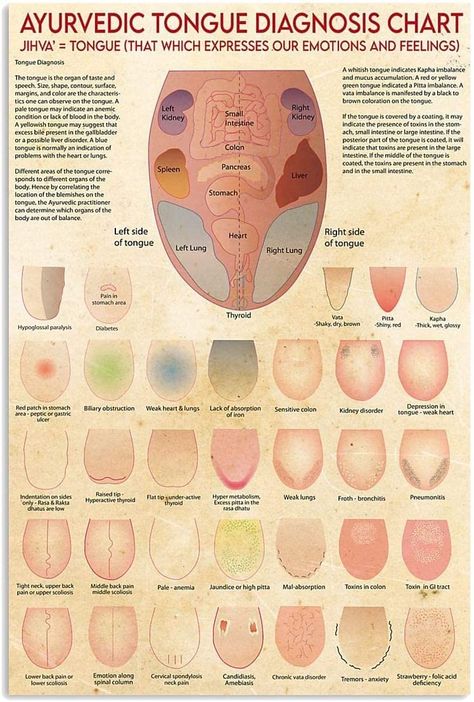 PRICES MAY VARY. Measure approximately sizes:8x12 inch(20x30 cm) Material:Ayurveda Tongue Diagnosis Chart Metal Tin Sign.The wall decorative signs is made of Aluminum/Tin metal.Durable,waterproof,high temperature resistance. Easy to install:The metal sign comes with 4 pre-drilled holes in the corners,can be mounted on the wall by nails on 4 corners or double-sided tape or blu--tack. Perfect Decoration: The metal signs is very suitable for bathroom, living room, bedroom, kitchen, classroom, guest Adrenal Fatigue, Healthy Thoughts, Functional Health, Medicine Chest, Ayurvedic Healing, Indian Foods, Tongue Health, Medical Terminology, Poster Home Decor
