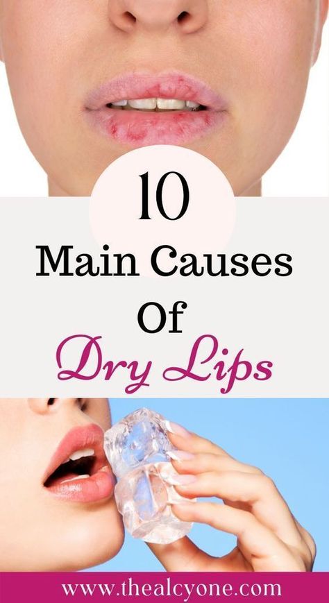 Dry Lips Remedy, Chapped Lips Remedy, Dehydrated Lips, Very Dry Lips, Dry Cracked Lips, Lip Care Routine, Cracked Lips, Peeling Skin, Smooth Lips