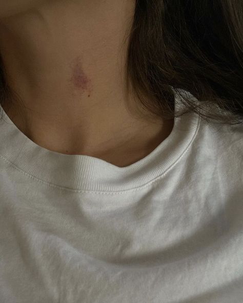 Hickies Neck Boys And Girl, Hicks On Neck, Hickies Neck, Cute Tumblr Pictures, Couples Vibe, Selfie Ideas Instagram, Trik Fotografi, Sweet Nothings, Aesthetic Grunge