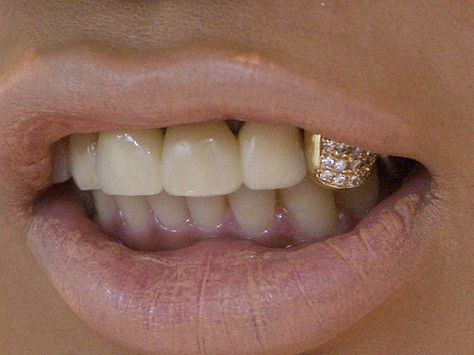 I want Golden Tooth, Rihanna Lyrics, Girl Grillz, Grillz Teeth, Gold Tooth, Diamond Grillz, Gold Grill, Diamond Teeth, Gold Grillz