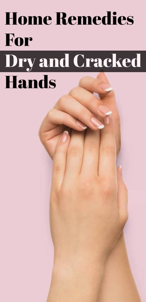 Home Remedies For Severely Dry and Cracked Hands| Dry Hands Remedy Homemade Peeling Hands Remedy, Soft Hands Remedy, How To Get Rid Of Dry Hands, Dry Cracked Hands Remedy, Cracked Hands Remedy, Hand Remedies, Dry Hands Remedy, Hand Scrub Diy, Dry Skin Diy