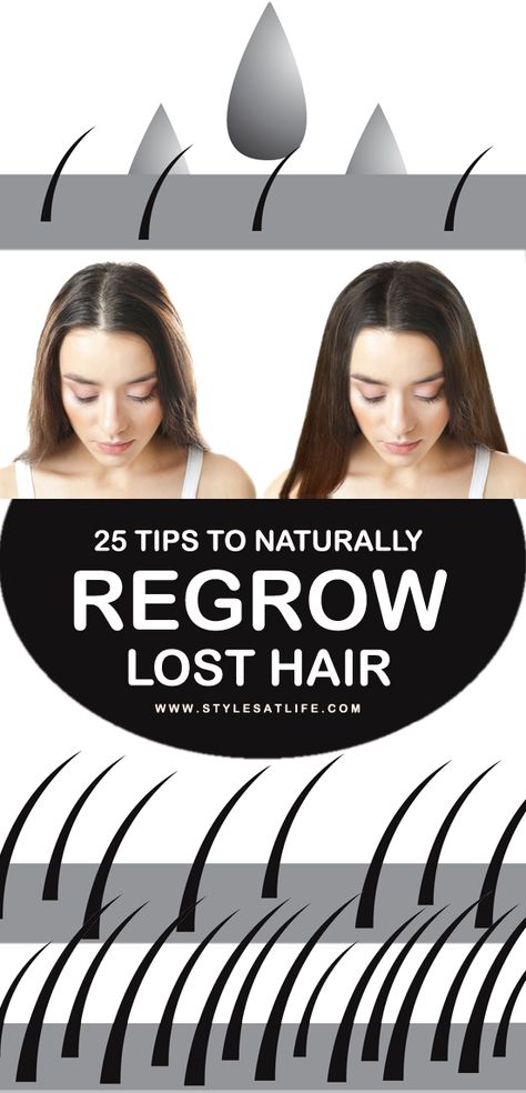 Best Hair Regrowth Products For Women, Hair Regrowth Tips, Regrow Lost Hair, Hair Formulas, Hair Regrowth Remedies, Regrow Hair Naturally, Stop Hair Breakage, Hair Repair Treatments, Healthy Natural Hair Growth