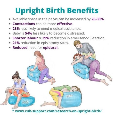 CUB upright birth positions doula sydney samantha gunn Birth Positions, Baby Delivery, Birth Affirmations, Pregnancy Labor, Baby Life Hacks, Childbirth Education, Birth Doula, Birth Labor, Baby Advice