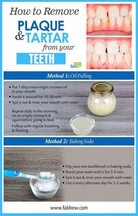 How to Remove Plaque and Tartar from Your Teeth - #Plaque #Remove #Tartar #Teeth #TakeCareOfOralHealth #ProperOralHygiene #BestOralCareAdvice #WhyIsOralCareSoImportant #HealthCareTips #WhatIsAOralCare #DoOralCare #HowToOralCare #WhyOralCareIsImportantForElderly How To Remove Plaque, Teeth Plaque, Tartar Teeth, Strong Teeth, Plaque Removal, Extra Virgin Coconut Oil, Teeth Health, Hygiene Care, Stronger Teeth