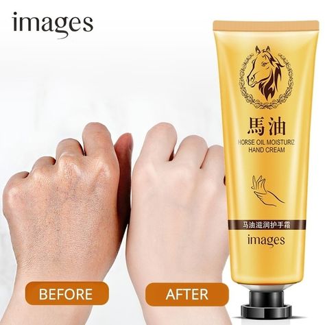 Hand Whitening, Anti Aging Hand Cream, Anti Aging Hands, Oil For Dry Skin, Cream For Dry Skin, Diy Vinyl, Dry Skin Care, Skin Care Cream, Whitening Cream