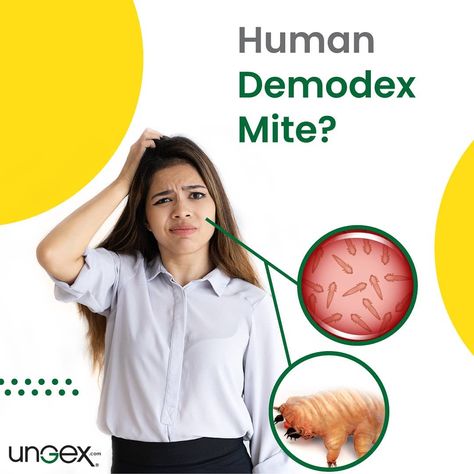 Mites On Humans, Skin Disease Pictures, Mites On Dogs, Diy Vinegar, Demodex Mites, Skin Parasites, Bug Spray Recipe, Population Density, Cat Biting