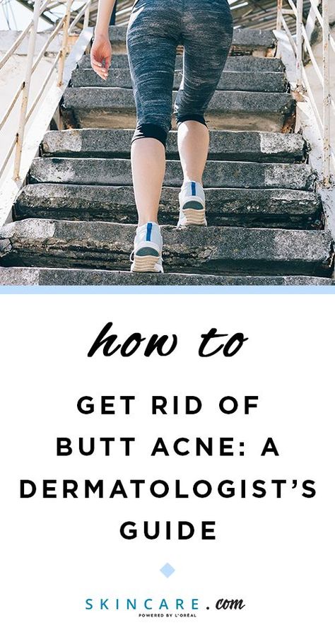 Got pimples on your buttocks? We're sharing an expert guide to folliculitis, or butt acne, including what causes the pesky bumps on your bum and how to get rid of them! #skin #skincare #skincareroutine #bodyacne #chestacne #backacne #shoulderacne #beauty #beautyroutine #beautyhacks #beautytips #beautyadvice #dermatologist #esthetician #springbeauty #skincarehelp #skincaretips #skincareadvice #skincarehacks #skincareroutineacne Buttocks Acne, What Causes Pimples, Shoulder Acne, Pimples On Buttocks, Chest Acne, Pimples Under The Skin, Be Uncomfortable, Bad Acne, Prevent Pimples