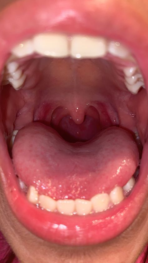 Open Mouth Reference Photo, Person With Mouth Open, Open Mouth Photography, Uvula Piercing, Mouth With Tongue Out, Spitting Into Mouth, Biting Reference, Mouth Open Reference, Finger On Mouth