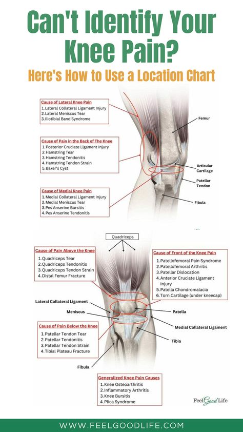 Struggling to identify your knee pain? Learn how to utilize a knee pain location chart to narrow down potential causes. With this guide, you can understand the intricate anatomy of the knee and how different types of pain correlate with specific conditions. Perfect for beginners and those seeking better knowledge about their body. #kneepain #painmanagement #healthtips #exercises #painlocationchart Medial Knee Pain, Anatomy Of The Knee, Knee Pain Relief Remedies, Patellofemoral Pain Syndrome, Pain Relief Remedies, Ligament Injury, Knee Exercises, Knee Pain Relief, Medical Anatomy