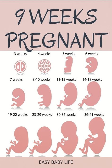 What does my baby look like at 9 weeks pregnant? Read all about baby size and looks and what is going on inside your baby bump during week nine of your pregnancy. Follow your first trimester week by week at www.easybabylife.com. Size Of Baby Week By Week, 30 Weeks Pregnant Belly, 9 Weeks Pregnant Symptoms, Baby Size By Week, Baby Week By Week, 7 Weeks Pregnant, First Week Of Pregnancy, 9 Weeks Pregnant, 10 Weeks Pregnant