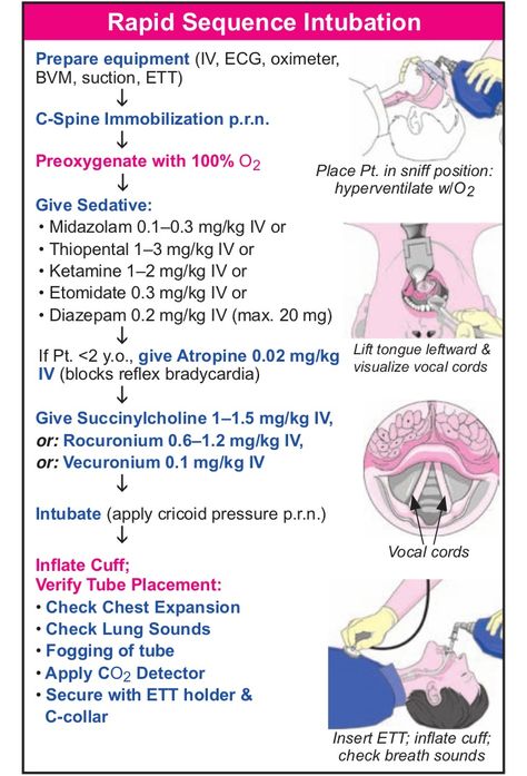 Rapid Sequence Intubation Er Nursing, Nurse Anesthesia, Paramedic School, Flight Nurse, Nurse Anesthetist, Nursing Mnemonics, Pharmacology Nursing, Critical Care Nursing, Best Nursing Schools