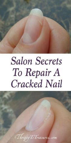 Cracked Nails, Broken Nails, Nail Repair, Nail Care Tips, Hair Hoco, How To Grow Nails, Homecoming Hair, Can Diy, Nail Health