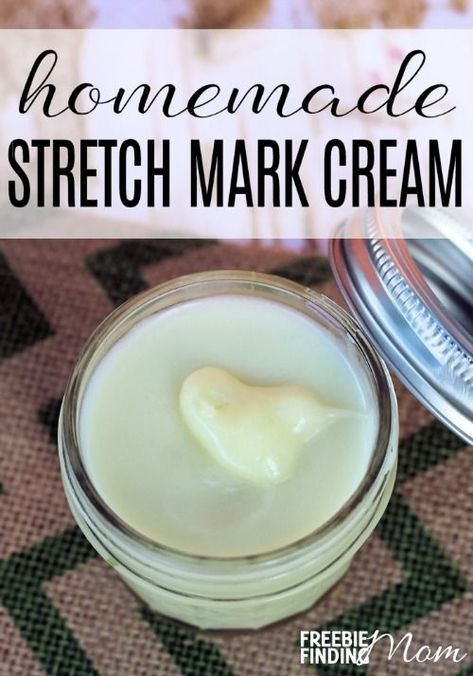 Marks Cream, Stretch Mark Cream, Being Pregnant, Stretch Mark, Diy Beauty Recipes, Homemade Remedies, Diy Body, Vitamin E Oil, Beauty Recipe