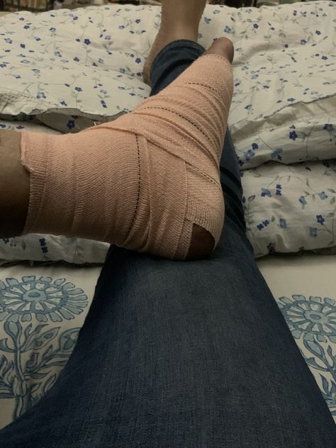 Fractured Leg Snap, Leg Fracture Photos, Leg Fracture Snap, Hand Fracture Pics, Leg Bandage Snapchat, Fracture Photo, Shelf Designs For Hall, Leg Fracture, Hand Fracture