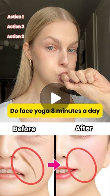 FaceYogi on Instagram: "8 minutes of face yoga every day, you’ll have your facial problems (smile lines, sagging cheeks,etc) stayed away. 

#facialmassage #facialexercise #getridofit #laughlines #smilelines #antiaging #facefit #facecare #faceyogi #faceyogiapp" Sagging Cheeks, Smile Lines, Facial Exercises, Face Yoga, Facial Massage, Face Care, Every Day, Facial, Yoga