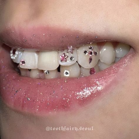 Teeth Gems, Pretty Teeth, Grillz Teeth, Gem Tattoo, Beauty Journal, Diamond Teeth, Tooth Gems, Grills Teeth, Glitter Bomb