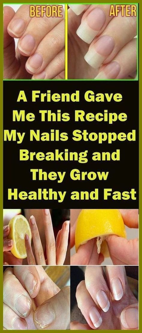 A Friend Gave Me This Recipe And My Nails Stopped Breaking And They Grow Healthy And Fast Nail Growth Tips Faster, Nail Growth Tips, Grow Nails Faster, Nail Hardener, Broken Nails, Nail Repair, How To Grow Nails, Brittle Nails, Nail Growth