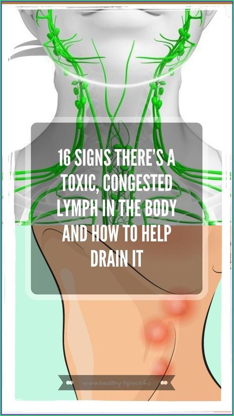 16 Signs There�s A Toxic, Congested Lymph In The Body And How To Help Drain It Lymph Fluid, Lymph Massage, Lymph System, Lymph Drainage, Healthy Advice, Diy Remedies, Health Planner, Lymph Nodes, Natural Therapy