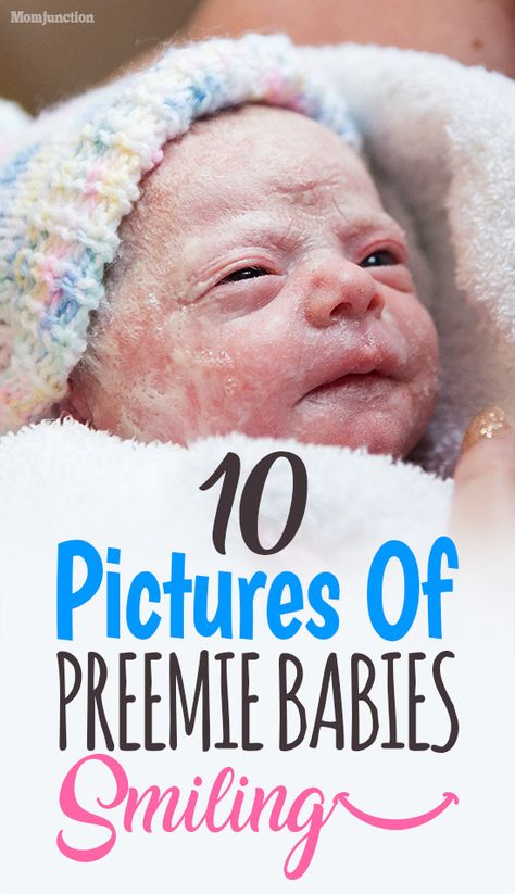 10 Pictures Of Preemie Babies Smiling Because They’re Happy To Have Made It : Here, we bring you a compilation of pictures of some of the sweetest little premature babies smiling. Trust us, these pics will just make your day #newborn #newborns #newmoms #babies #motherhood Preemie Babies Pictures, Circumcision Care Newborn, Premature Baby Development, Tummy Time Newborn, Preemie Baby Girl, Preemie Boy, Premie Baby, Baby Essentials Newborn, Micro Preemie