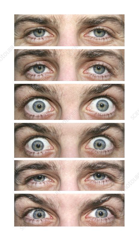 Eye expressions - Stock Image - P420/0568 - Science Photo Library Lighting Angles, Eye Study, Portrait Color, Eye Expressions, 얼굴 드로잉, Face Drawing Reference, Photographie Portrait Inspiration, Anatomy Sketches, Human Reference