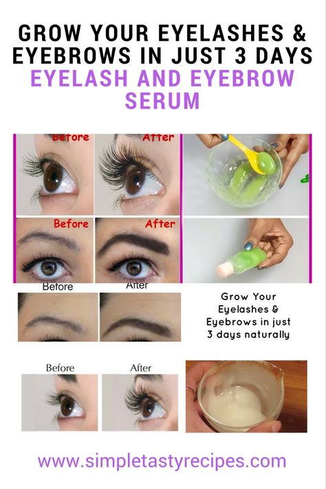 Grow your eyelashes & eyebrows in just 3 days  Eyelash and Eyebrow serum Grow Longer Thicker Eyelashes, Grow Your Eyelashes, Diy Eyelash Growth Serum, Long Thick Eyelashes, Diy Serum, Eyelashes And Eyebrows, Eyebrow Serum, How To Grow Eyelashes, How To Grow Eyebrows