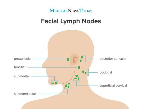 Salivary Gland Infection, Remedy For Sinus Congestion, Home Remedies For Sinus, Sinus Congestion Relief, Parotid Gland, Lymph Node, Lymph Glands, Lymph Vessels, Lymph Fluid