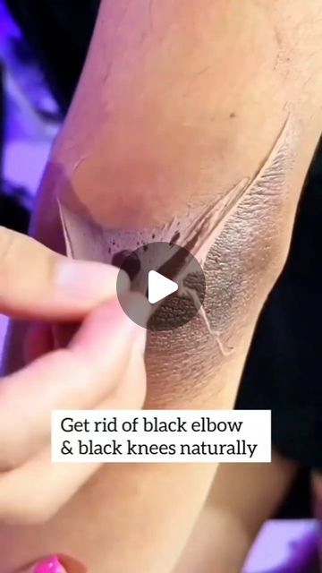 Pihu officials on Instagram: "Get Rid of Dark Elbow/Knees Naturally   . . . #darkelbows #dark #viralreels #trandingreels #skincareblogger #skincare #darkknees #darkelbowandknees #instagramreels #instagood" Essen, Cracked Heel Remedies, Dark Spots On Legs, Dark Elbows, Spots On Legs, Dark Underarms, Diy Skin Care Routine, Dark Spots On Skin, Perfect Skin Care Routine