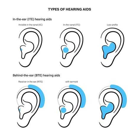 Hearing Aids | Johns Hopkins Medicine Hearing Aid Reference, Hearing Aids Accessories, Audiology Student, Sign Languages, Deaf Awareness, Middle Ear, People Drawing, Deaf Culture, Hearing Health