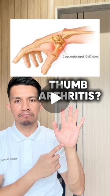 Madz Mariwa 🇵🇭 on Instagram: "THUMB ARTHRITIS EXERCISES! FAST RELIEF 🤩🤩🤩 

#viral #arthritis #arthritisrelief #exercise" Thumb Exercises, Thumb Pain Relief, Trigger Finger Exercises, Hand Therapy Exercises, Carpal Tunnel Exercises, Flexibility Stretches, Target Workout, Finger Exercises, Yoga Hands