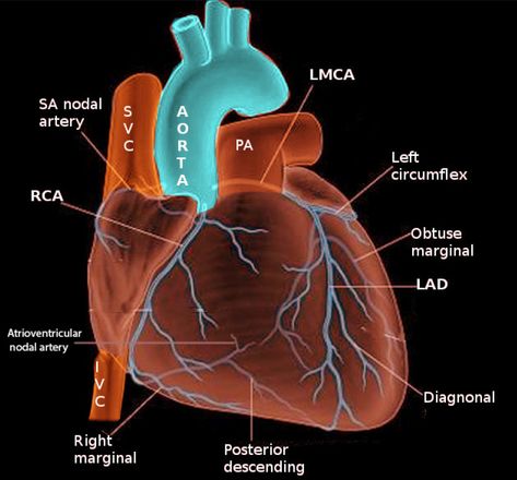 Coronary Circulation, Arteries Anatomy, Heart Diagram, Nurse Problems, Human Body Facts, Coronary Artery, Heart Anatomy, Nursing Books, Atrial Fibrillation