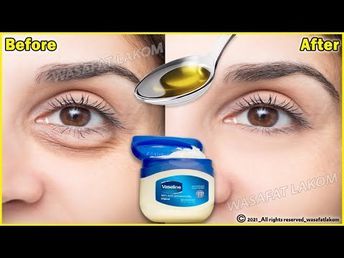 Eye Wrinkles Remedies, Face Wrinkles Remedies, Puffy Eyes Remedy, Wrinkles Remedies Face, Wrinkle Remedies, Eyes Dark, Natural Face Skin Care, Under Eye Wrinkles, Remove Dark Circles