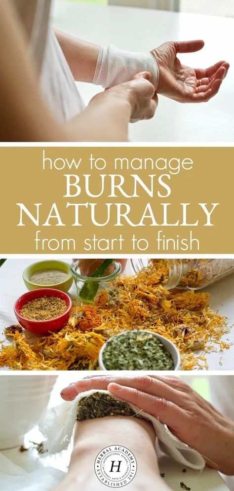 How To Manage Burns Naturally From Start To Finish Ancient Remedies, Best Cough Remedy, Common Knowledge, Kitchen Herbs, Natural Drinks, Cold Home Remedies, Natural Cough Remedies, Cough Remedies, Oral Health Care