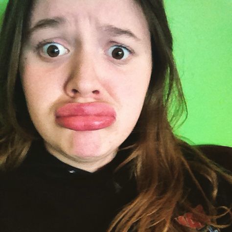 Kylie Jenner Lip Challenge Lips, Kylie Jenner, Kylie Jenner Lip Challenge, Growing Up In The 2000s, Kylie Jenner Lip, Kylie Jenner Lips, Kyle Jenner, Photo Dump, Quick Saves