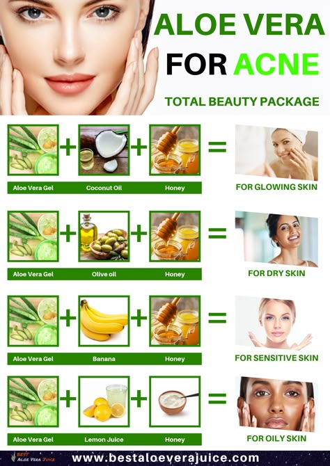 Aloe Vera for Acne Total beauty package. The antibacterial properties of #aloe_vera_gel are very effective in treating acne and reducing the redness caused by it. It prevents bacteria from infecting #acne wounds and accelerates the process of healing. Its anti-fungal properties are useful in treating inflammation like boils and cysts on the #skin. #Aloe_Vera_for_Acne #AloeVera_gel #beauty_package Alovera Gel For Face Benefits, Aloe Vera For Oily Skin, Aloe Vera For Acne Before And After, Aloevera Skincare For Acne, Does Aloe Vera Help Acne, How To Apply Aloe Vera To Face, Aleo Vera For Face Glow, Aloe Vera For Eyelashes, How To Use Aloe Vera Gel For Face