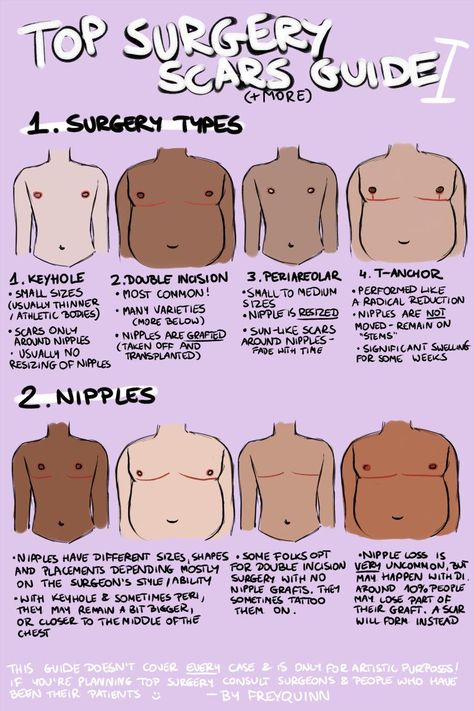 n. frey @ commissions open • B.L.M on Twitter: "TOP SURGERY scars(+more) guide ✨ i have seen very few guides on drawing chests that have undergone top surgery & the few i've seen were very flawed, so now that i've recovered from my own surgery i decided to draw my own! this may have more parts if i remember more stuff!… https://t.co/LA0pAo1PfE" Top Surgery Scars, Trans Tips, Trans Things, Top Surgery, Trans Art, Trans Boys, Losing 40 Pounds, Tweek Y Craig, Trans Pride