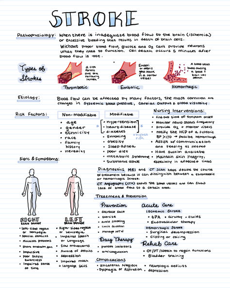 The most important info to study as a nursing student about strokes. Pathophysiology Nursing Study Guides Respiratory, Studying In Nursing School, Neuro Med Surg Nursing, Emt Study Notes, Nursing Tips Student, Pre Nursing Student Tips, Fundamentals Of Nursing Study Guide, Medical Surgical Nursing Notes, Nursing Student Essentials