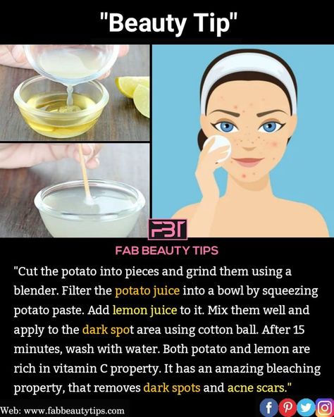 How To Get Rid Of Marks On Face, How To Remove Pimple Marks On Face, Diy Acne Scar Remover, Dark Marks On Face How To Get Rid Of, How To Remove Acne Marks, How To Get Rid Of Acne Marks, Acne Marks Remedies, Remedies For Back Acne, Face Cleaning Routine