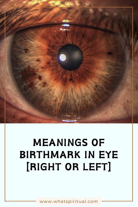 Meanings of Birthmark in Eye [Right or Left Eye Freckle] 2 Eye Of Thoth, Parts Of The Eye, Left Eye, Spiritual Health, Spiritual Meaning, Shoulder Pain, Life Path, Personality Traits, Human Experience