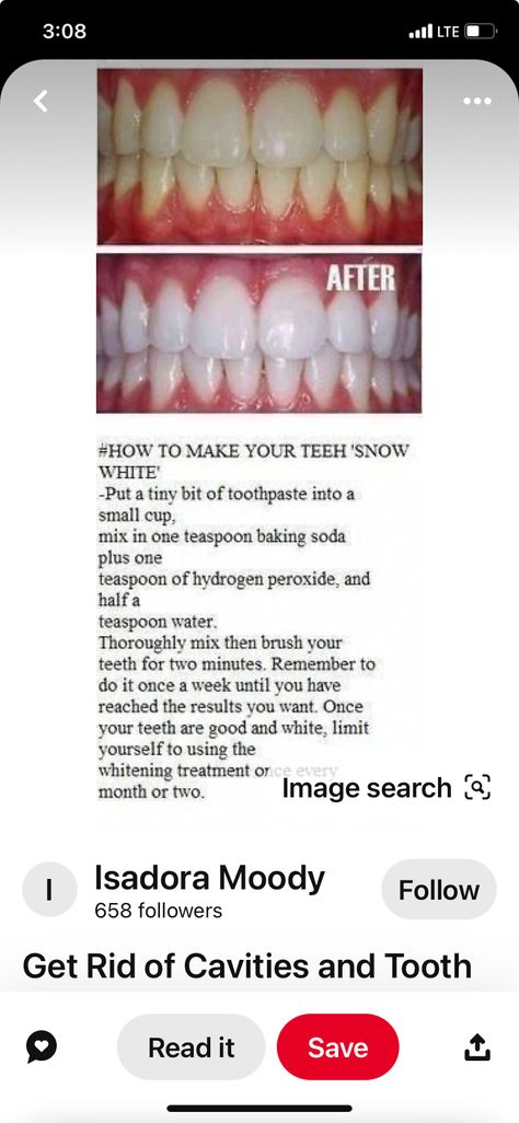 How To Get Perfect Teeth, How To Brighten Your Teeth, Food That Whitens Teeth, Foods To Eat To Get Whiter Teeth, How To Whiten Teeth With Braces On, How To Withen Teeth, White Teeth With Braces, Easy Ways To Whiten Your Teeth, How To Get White Teeth