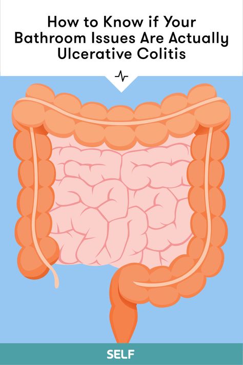 Abdominal Cramps, Inflammatory Bowel, Receding Gums, Large Intestine, Natural Pain Relief, Types Of Cancers, Boost Your Metabolism, How To Know, Disease