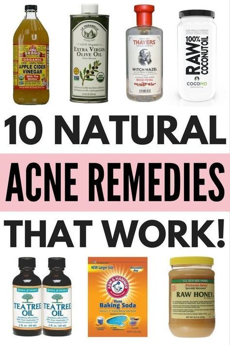 Honey Baking, Kat Diy, Coconut Oil For Acne, Skin Care Routine For 20s, Diy Acne, Get Rid Of Acne, Natural Acne Remedies, Natural Acne, Rid Of Acne