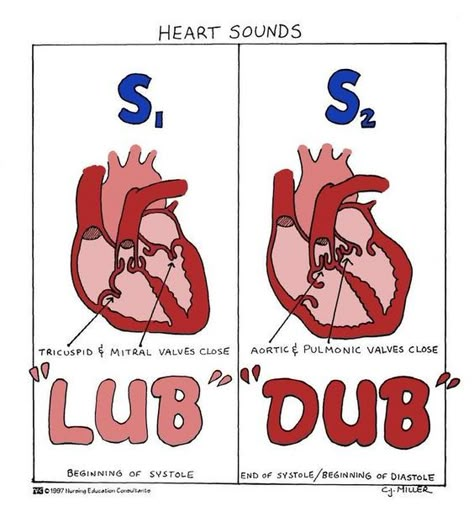 Cardiac Assessment, Medical Assistant Student, The Normal Heart, Nursing School Essential, Heart Sounds, Heart Valves, Medical School Life, Nursing School Motivation, Nurse Study Notes