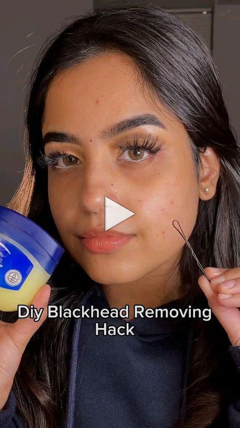 Ways To Remove Blackheads, Blackhead Remover Diy, To Remove Blackheads, Rid Of Blackheads, Blackhead Mask, Natural Face Skin Care, Routine Skin, Natural Acne Remedies, Remove Blackheads